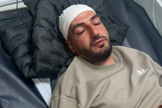 الاحتلال يصيب شابا بقنبلة غاز في رأسه ببلدة الرام شمال القدس