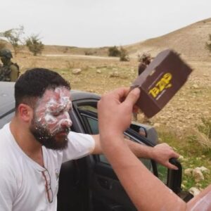 إصابة 4 مواطنين إثر هجوم للمستوطنين على متنزّهين شمال أريحا