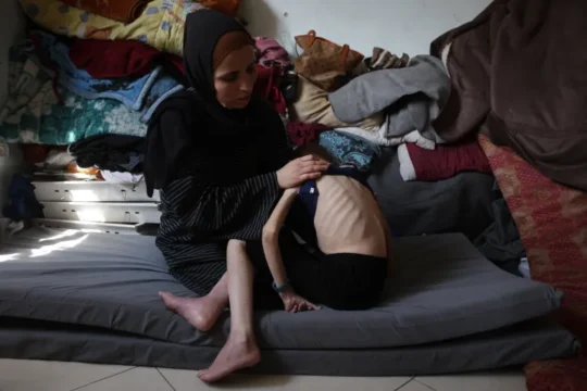 الجوع يتفشى في غزة في ظل حصار خانق يفرضه الاحتلال ويمنع دخول الماء والغذاء والدواء (الفرنسية)