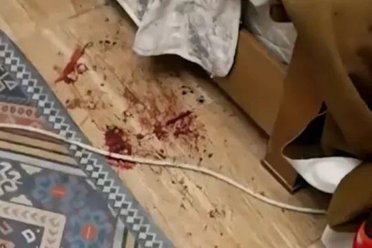أثناء نومه وبدم بارد.. الاحتلال يعدم شابا فلسطينيا بـ4 رصاصات في قلقيلية