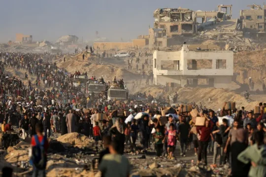 حماس: المجاعة وسوء التغذية يفتكان بأطفال غزة