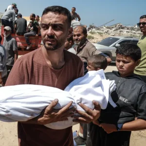 مستشفى الشفاء يعلن وفاة 21 طفلا جراء التجويع في غزة