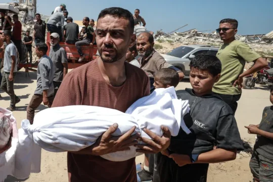 مستشفى الشفاء يعلن وفاة 21 طفلا جراء التجويع في غزة