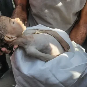 أرواح غزة تتساقط تحت مقصلة التجويع وتحذيرات من موت جماعي