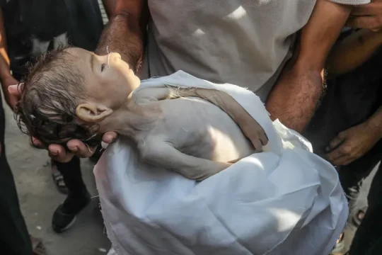 أرواح غزة تتساقط تحت مقصلة التجويع وتحذيرات من موت جماعي