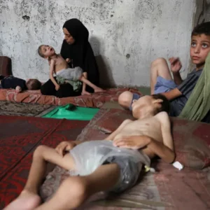 واشنطن بوست: أهل غزة يتضورون جوعا فما أثر الجوع على جسم الإنسان؟