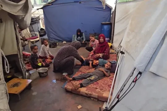 الأمم المتحدة: واحد من كل 3 فلسطينيين بغزة لم يأكل منذ أيام