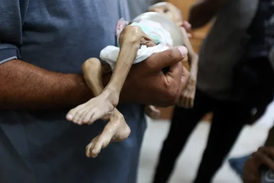 7 وفيات جديدة بسبب التجويع بغزة وسوء التغذية يهدد مئات الآلاف