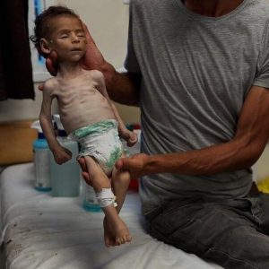 الصحة بغزة: 9 وفيات جديدة بسبب المجاعة وسوء التغذية خلال 24 ساعة