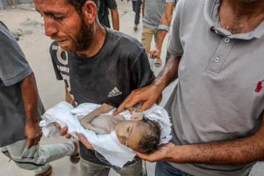 7 شهداء بيوم واحد جراء التجويع بغزة وتحذيرات من تفاقم الوضع