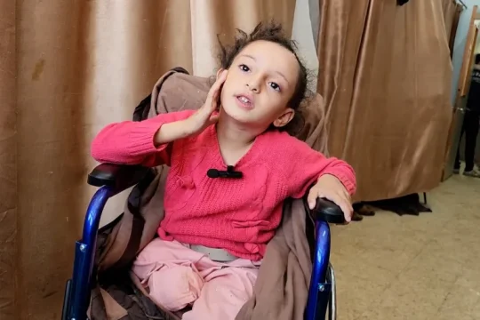 21 ألف طفل في غزة يعانون إعاقات منذ بدء الحرب
